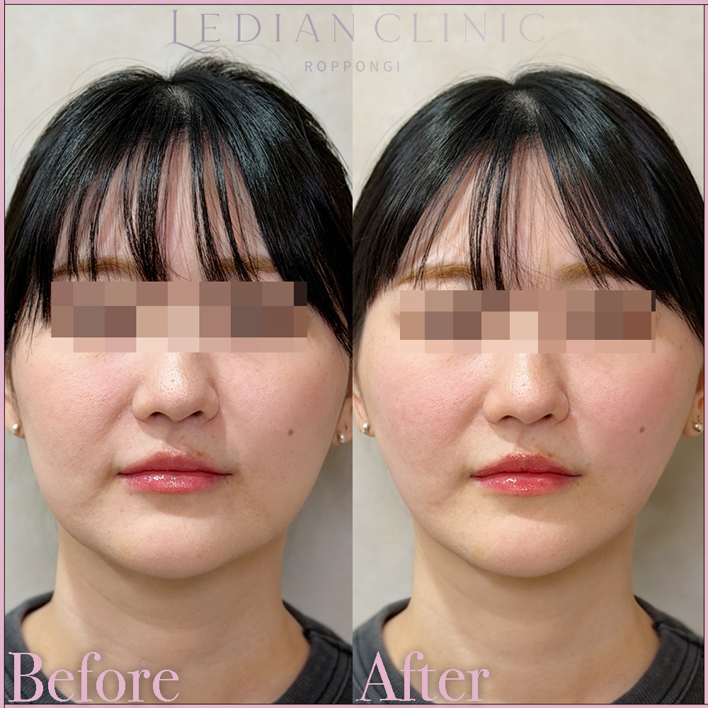 症例写真