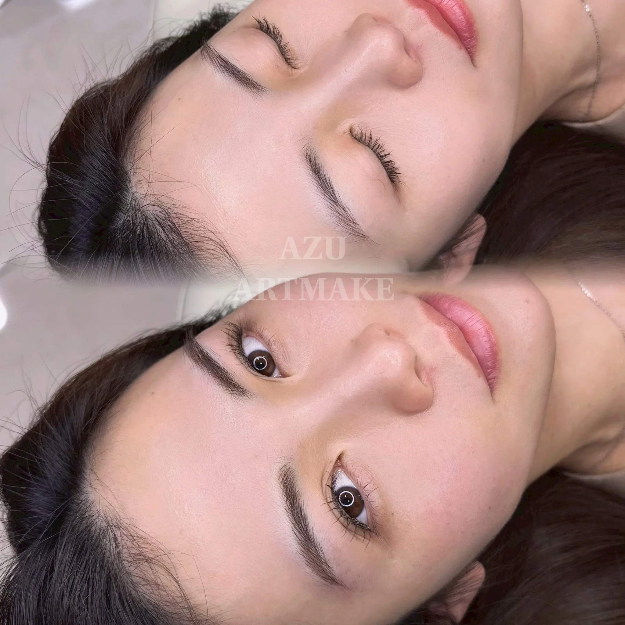 症例写真