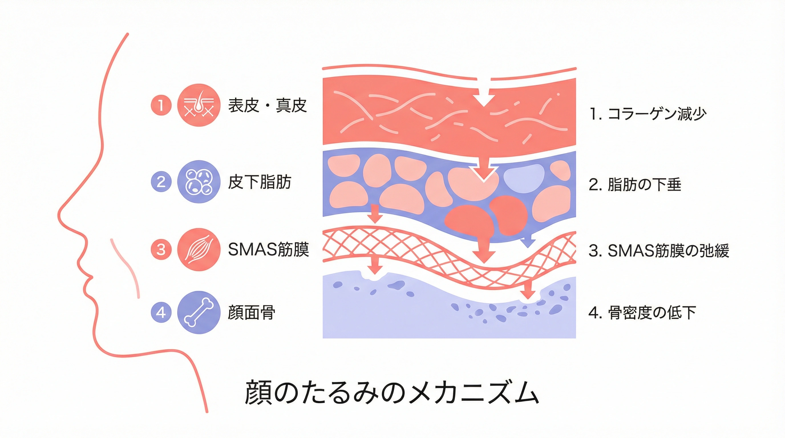 加齢による顔のたるみメカニズム解説図