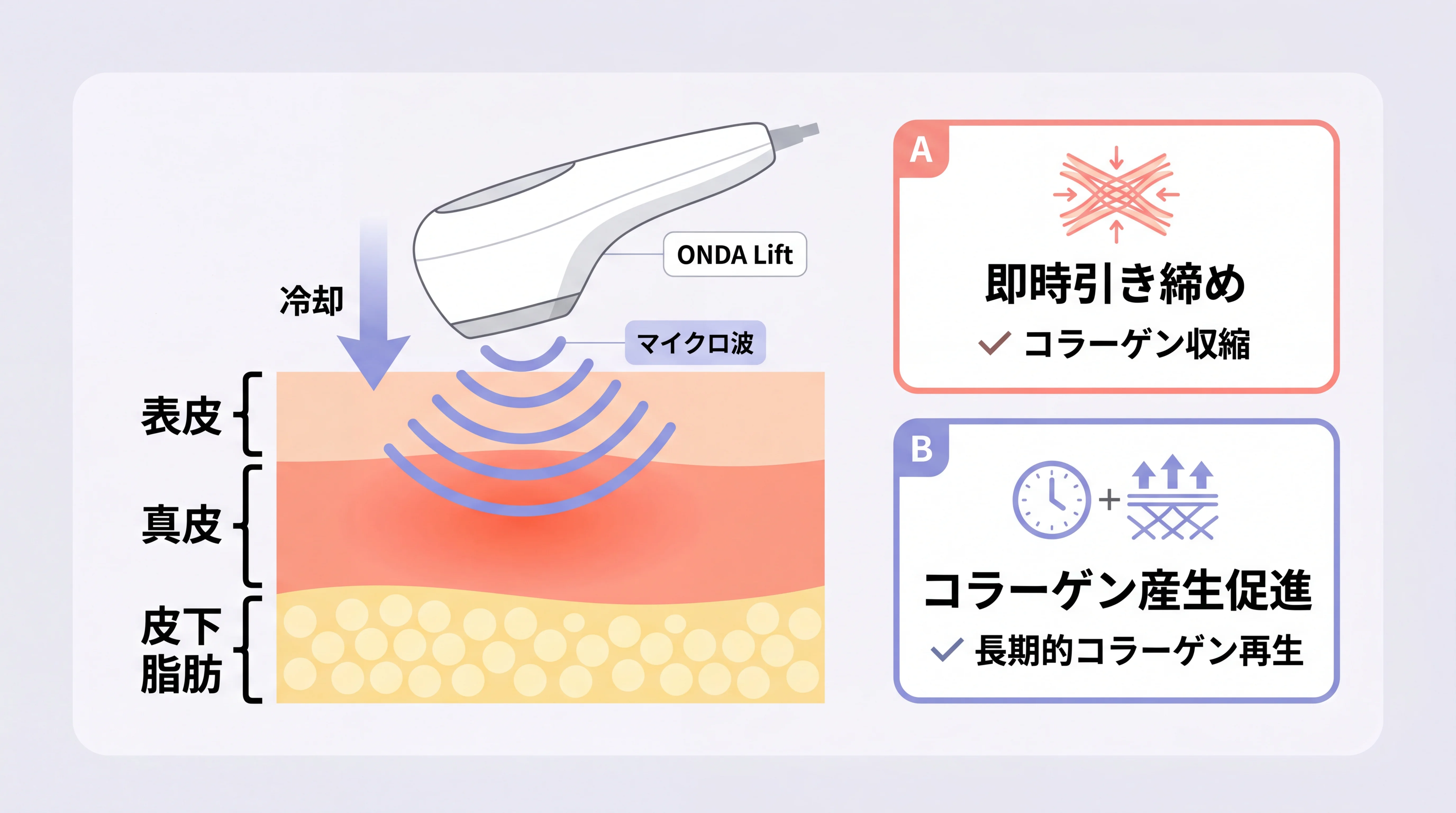 オンダリフトの仕組みとアプローチ層