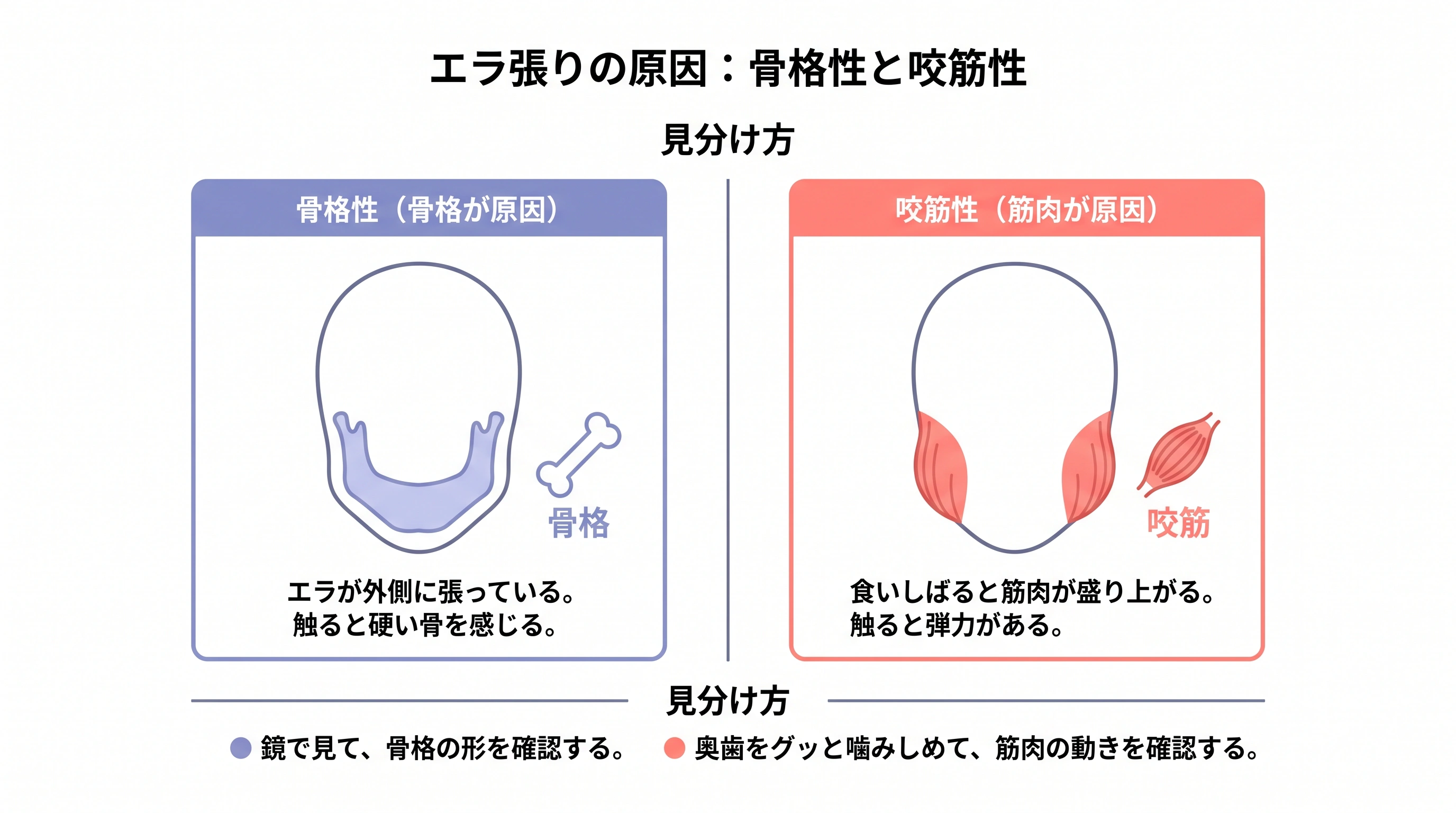 エラ張りの原因を骨格性と咬筋性に分けて見分ける比較図