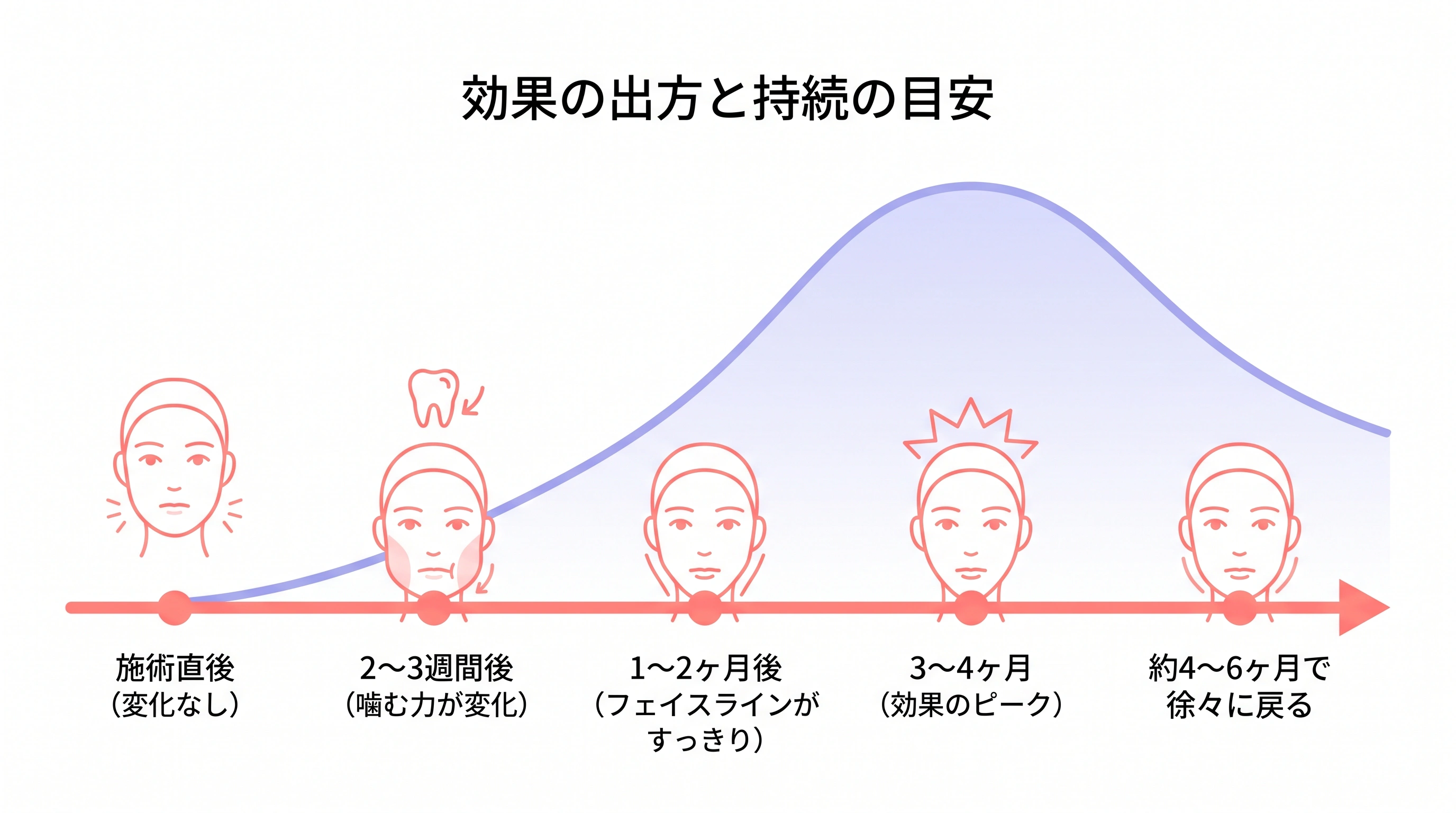 エラボトックスの効果が出るまでの経過と持続期間を示すタイムライン