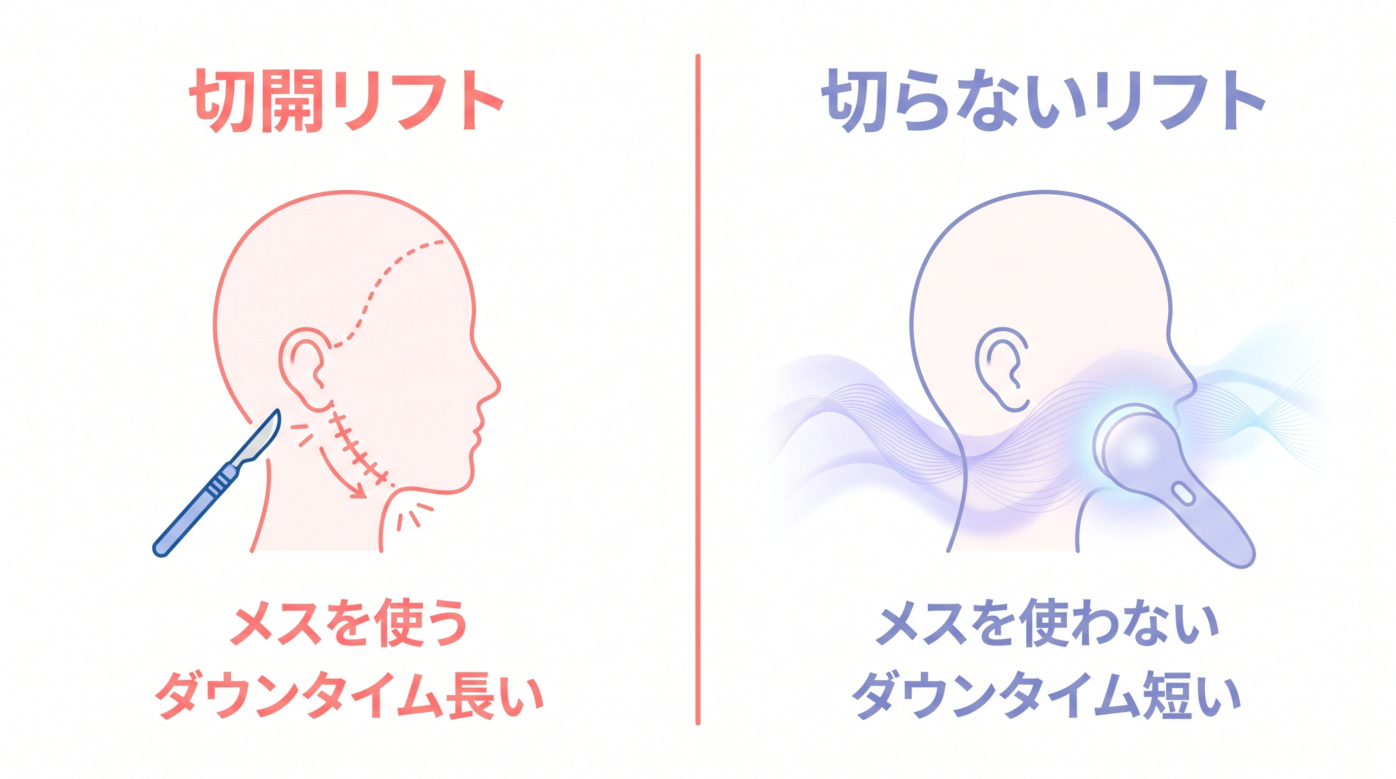 切る（切開）リフトと切らないリフトの違いを比較した概念図