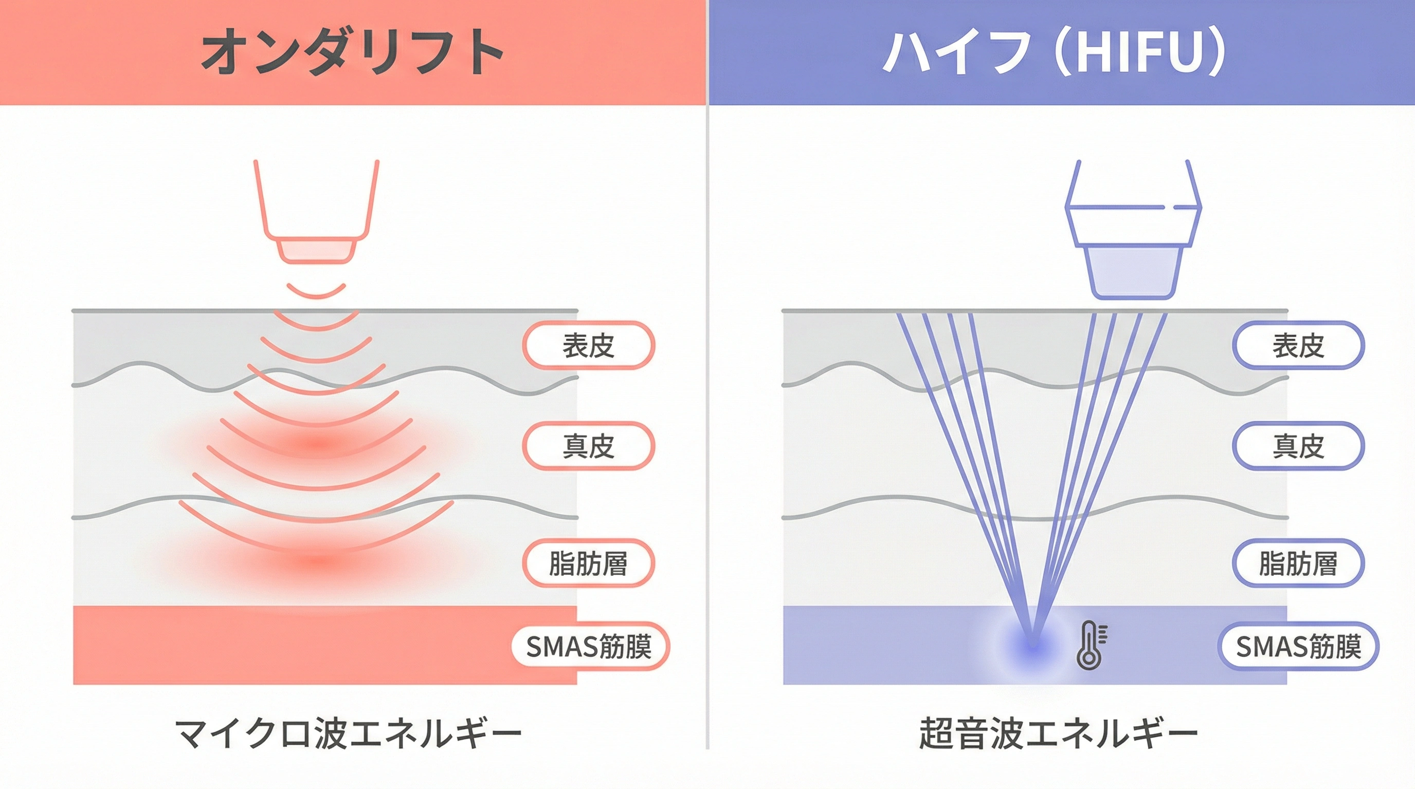 オンダリフトとハイフの作用層の違いを比較した図解