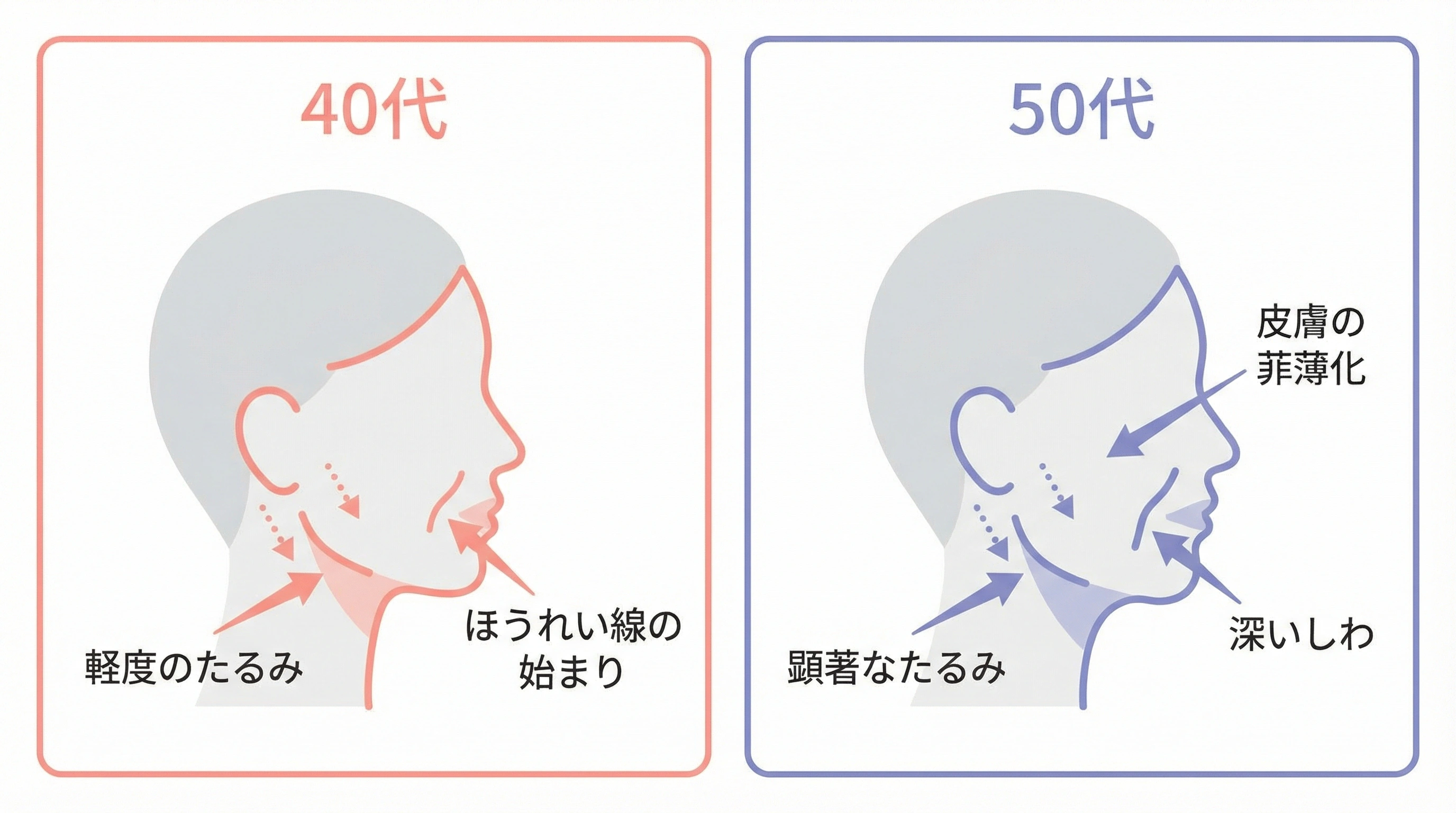 40代と50代のたるみの違い