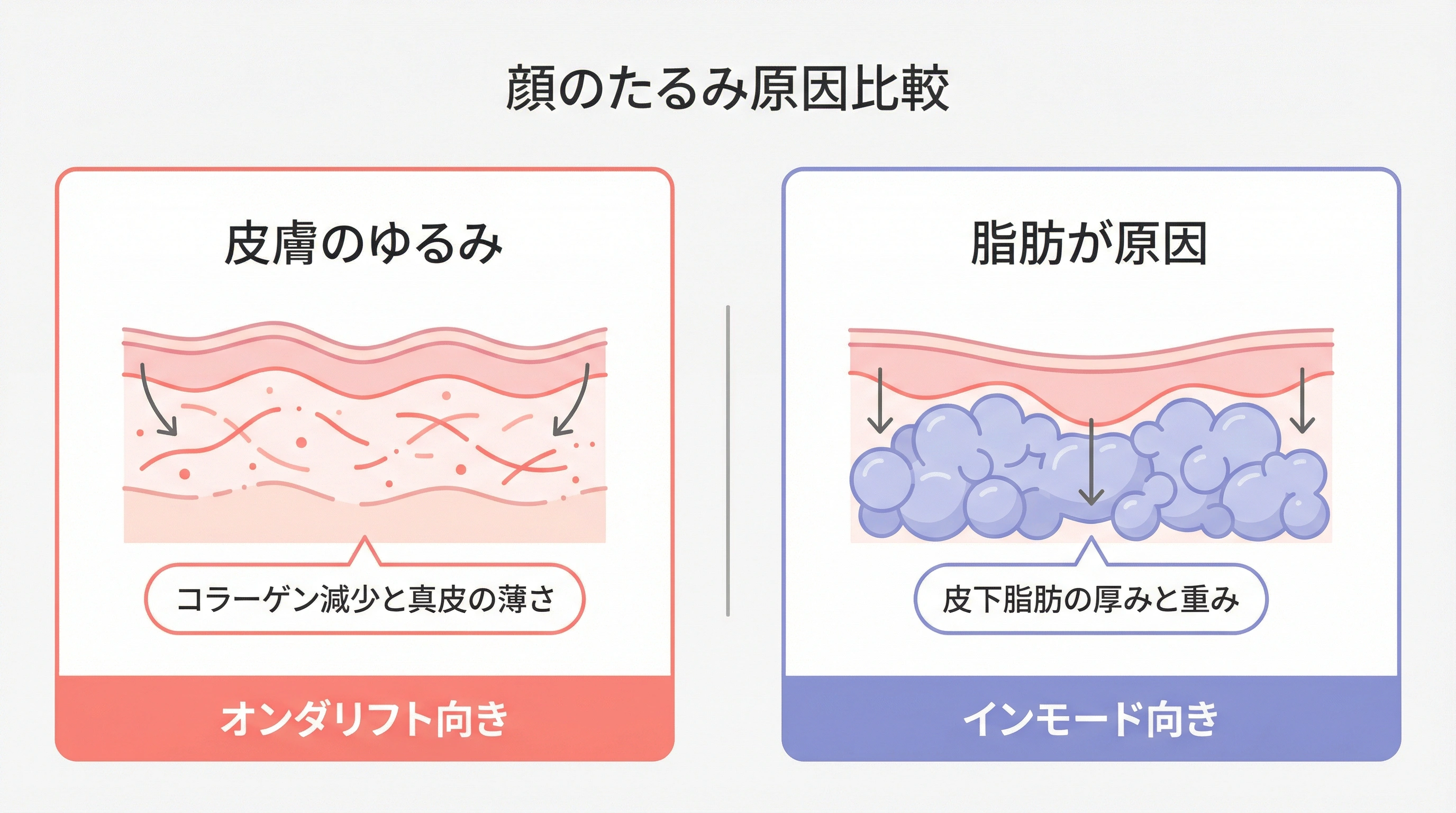 皮膚のゆるみと脂肪が原因のたるみの違い