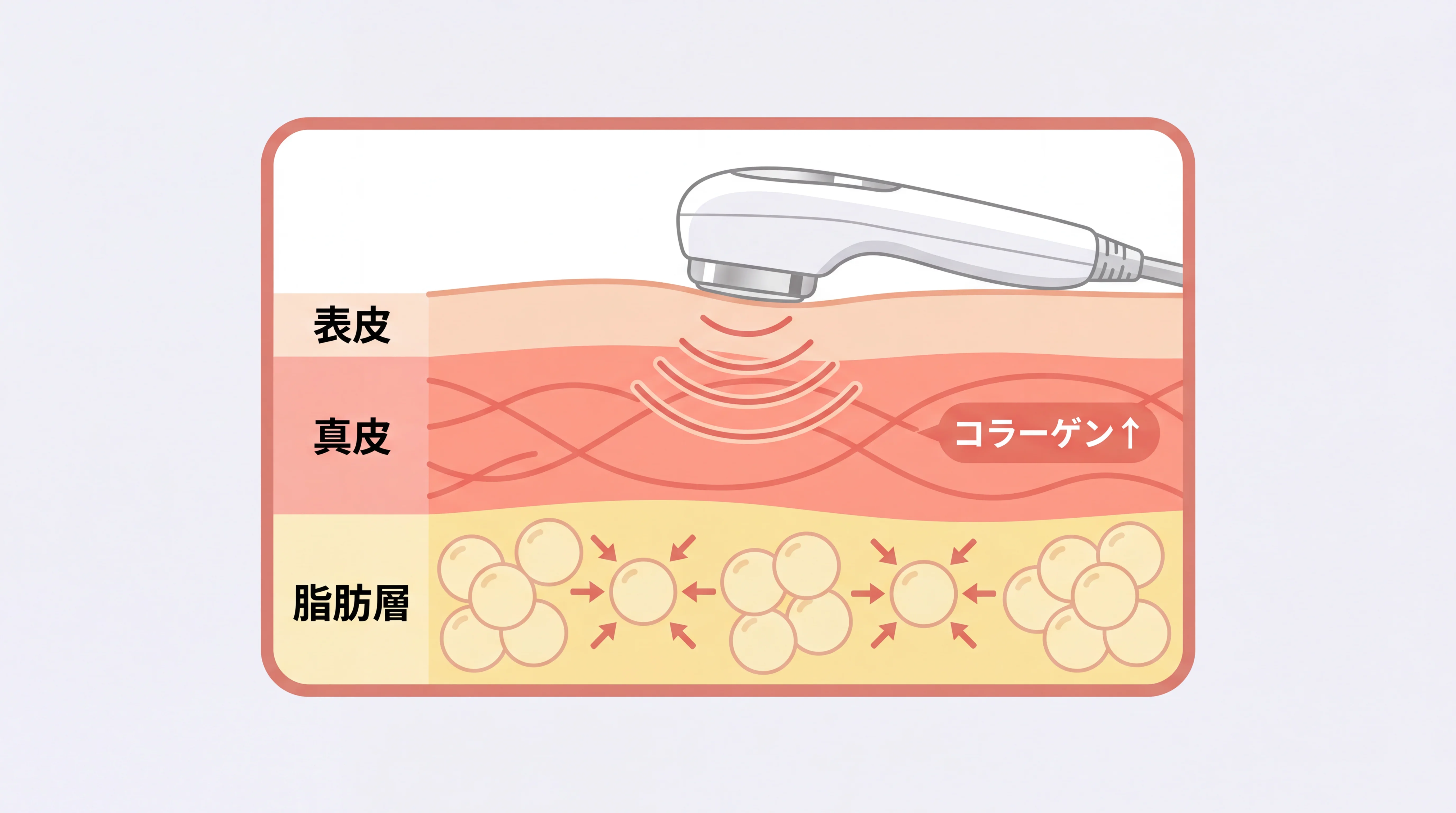 オンダリフトの仕組みイメージ
