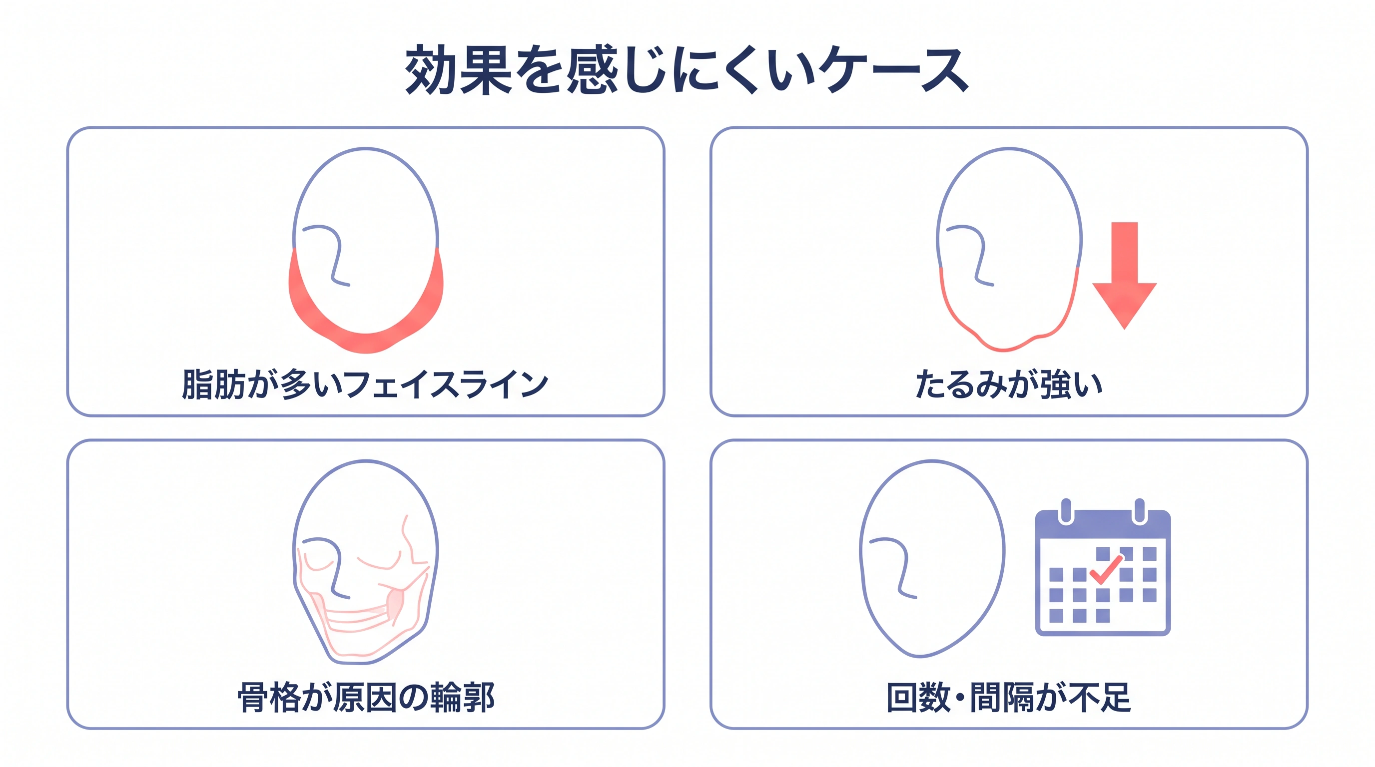 オンダリフトの効果を感じにくい4つのケースの図解