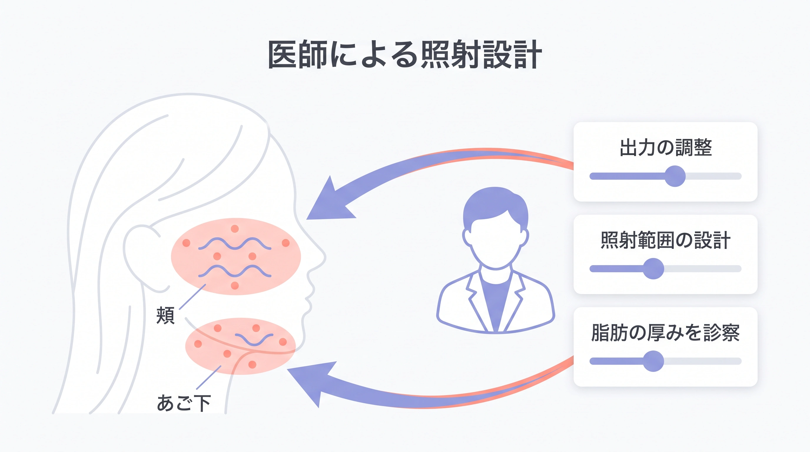 医師による照射設計の考え方(診察・出力調整・照射範囲の設計)