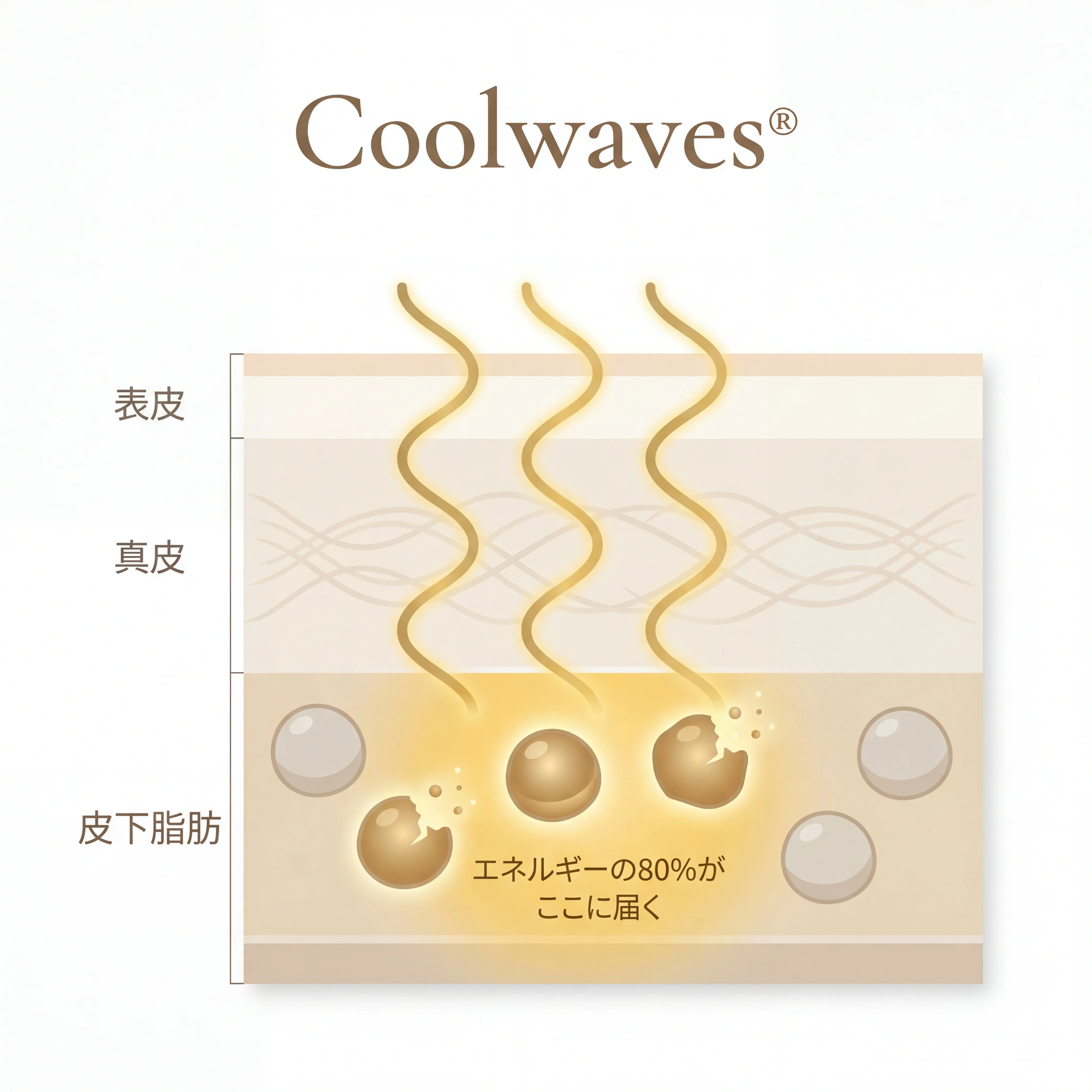 オンダリフトの仕組み