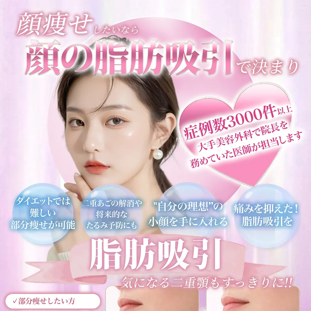 顔の脂肪吸引