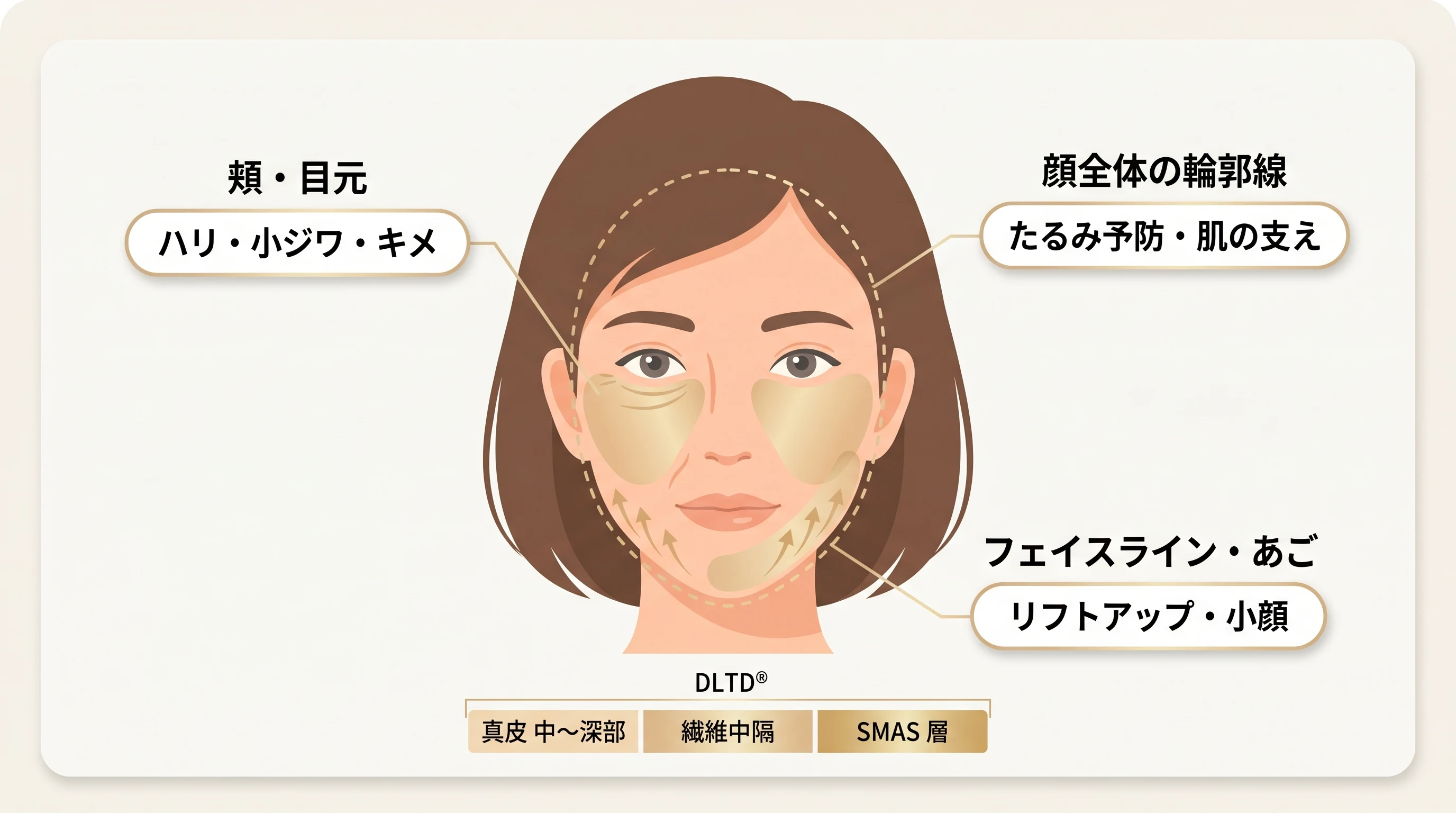 DLTD® 多層加熱で得られる主な効果の部位マップ