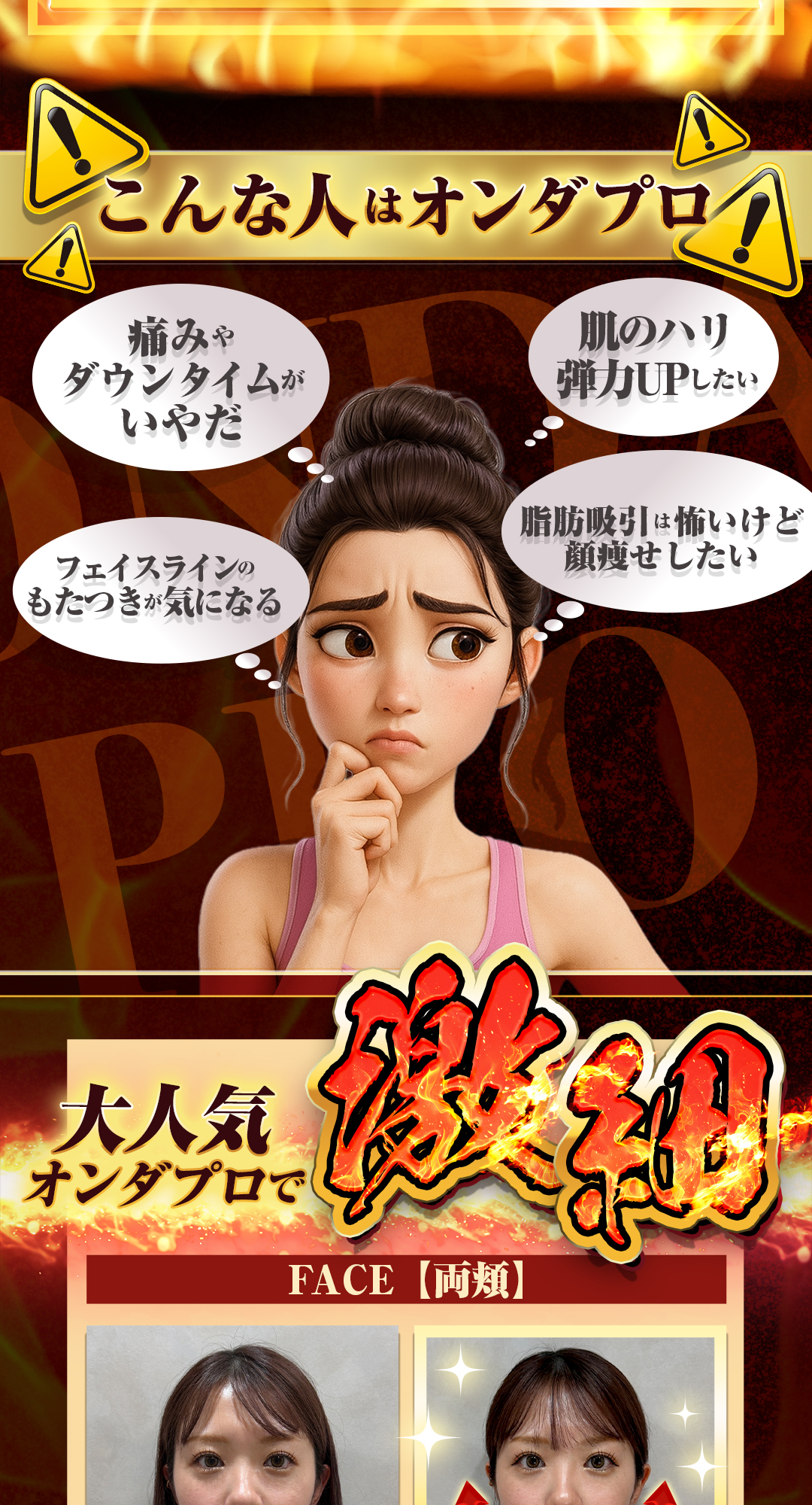 オンダプロ