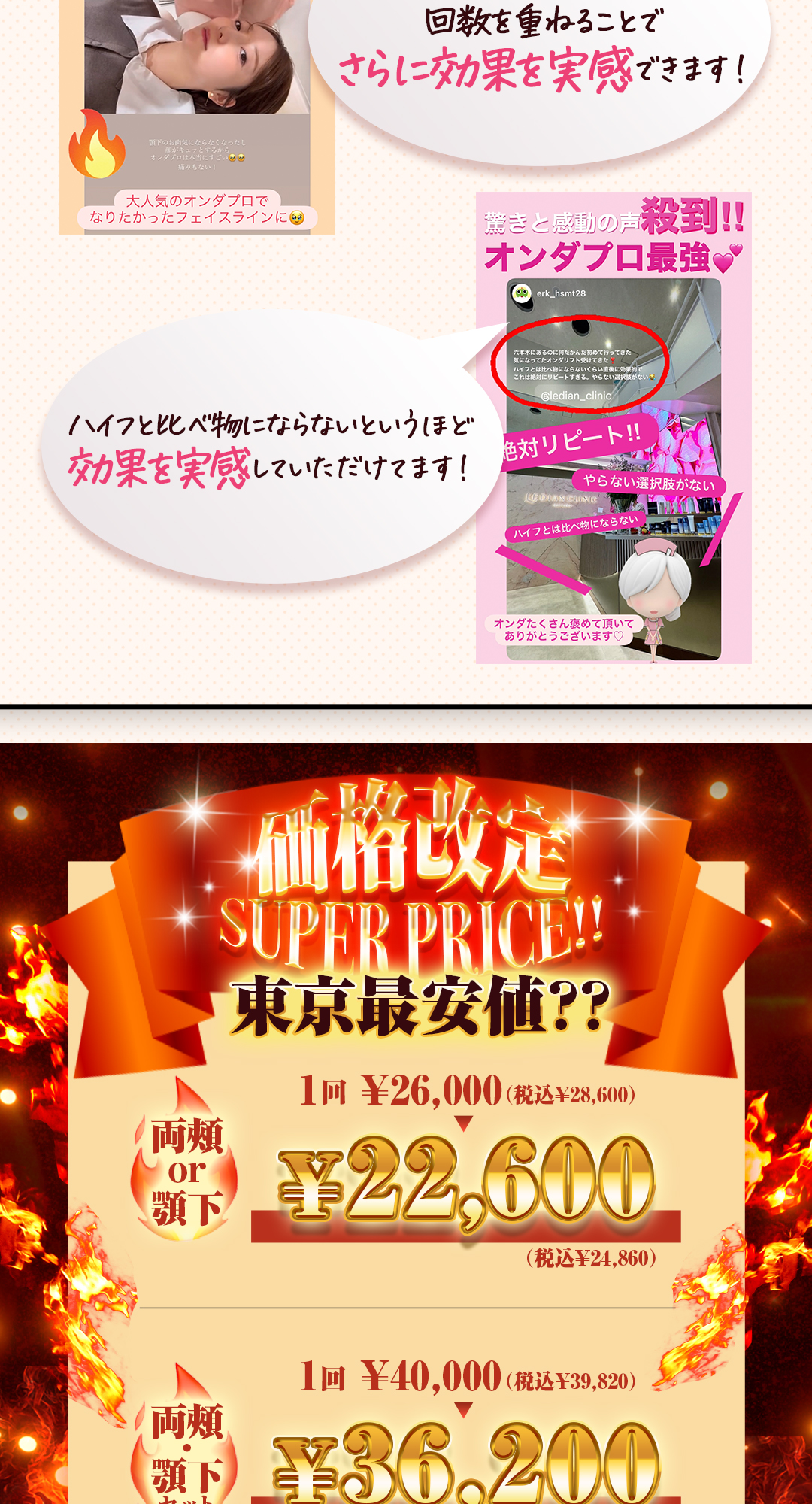 オンダプロ